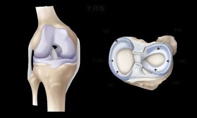 『附一科普』看完世界杯，技痒想踢球？新手最容易中招的3大膝盖损伤，千万别硬扛！