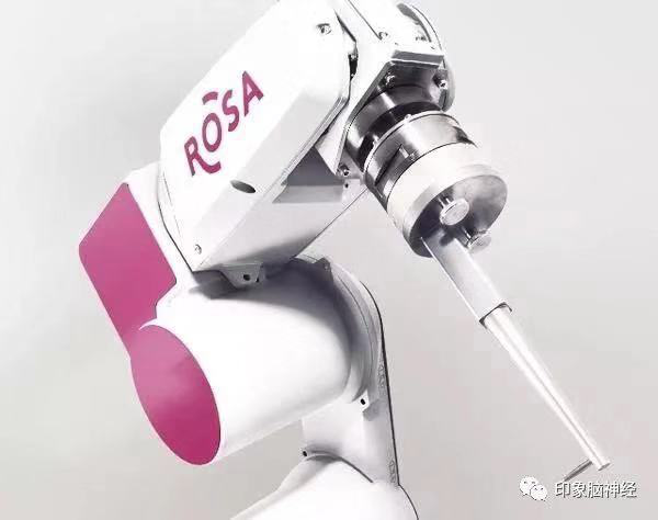 全国首例！我院利用国际新技术ROSA机器人 植入丘脑前核脑起搏器电极治疗癫痫