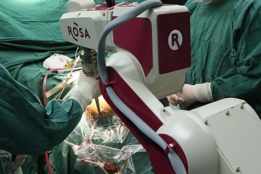 『媒体看附一』帕金森手术进入机器人时代 『媒体看附一』帕金森手术进入机器人时代