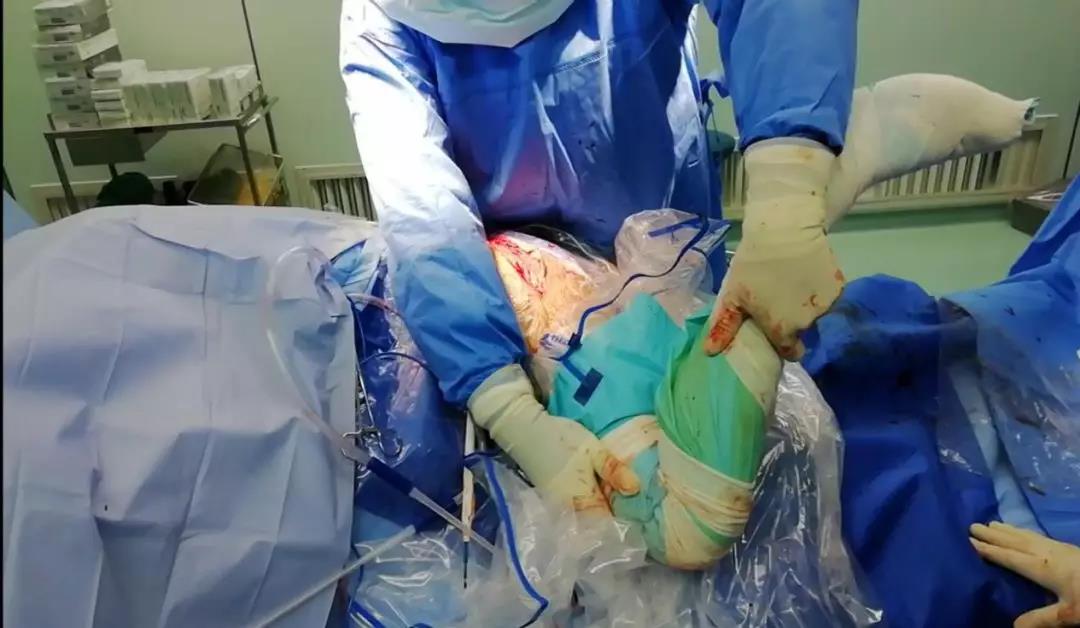 『媒体看附一』全副武装 医生穿“太空服”做手术 『媒体看附一』全副武装 医生穿“太空服”做手术