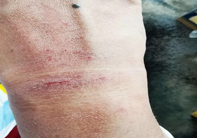 冲锋前线 只为救人 —— 感染科抗疫纪实 冲锋前线 只为救人 —— 感染科抗疫纪实