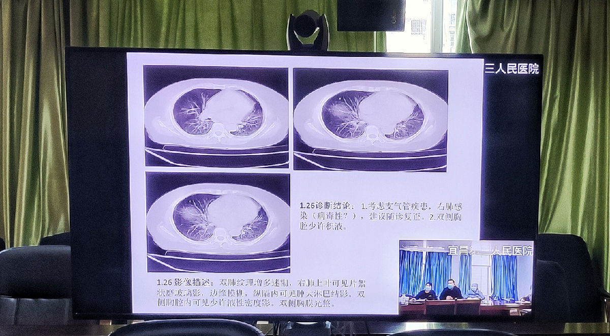 远程会诊 情系宜昌 远程会诊 情系宜昌